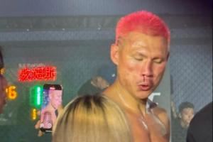 🤯太狠!恶鼠被威姆斯一拳打到鼻梁已经出现歪斜!
